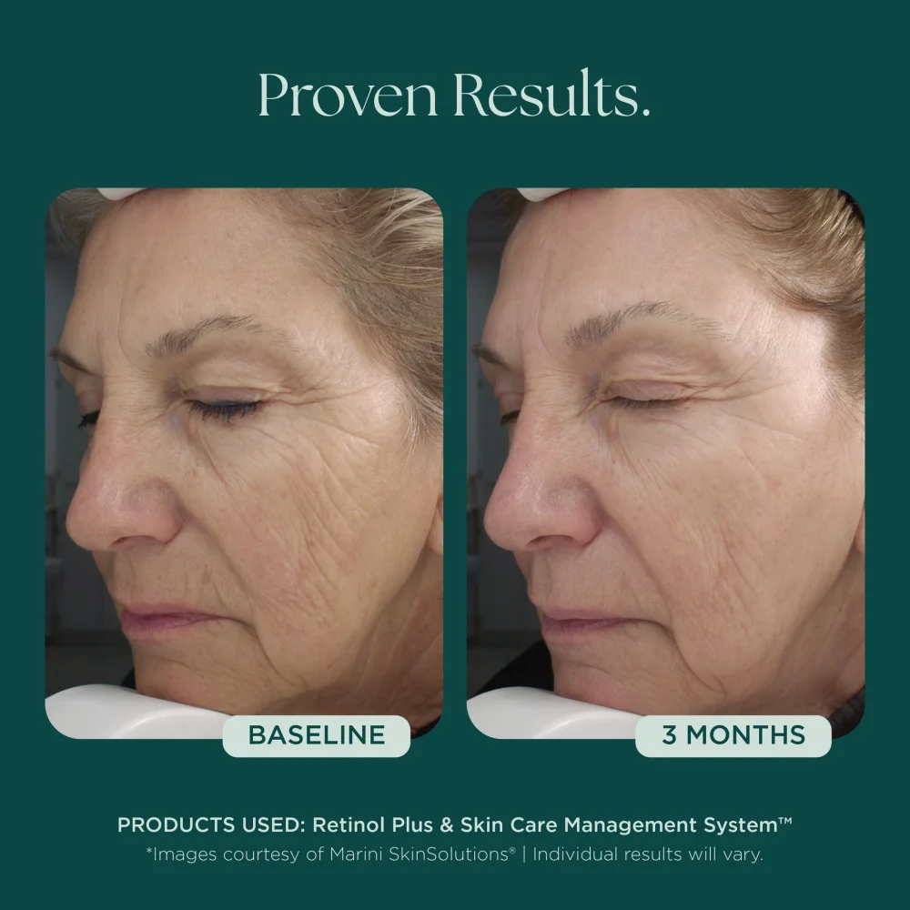 Retinol Plus (Copy) - Image 2