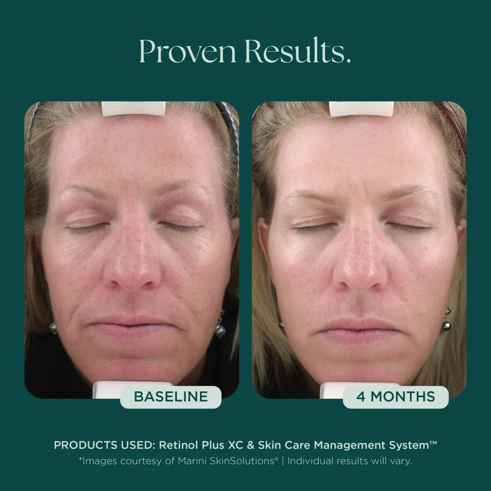 Retinol Plus (Copy) - Image 3