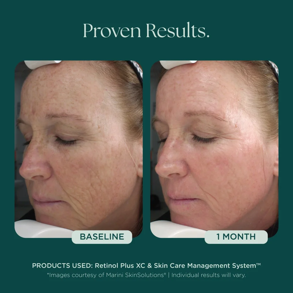 Retinol Plus (Copy) - Image 4